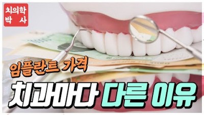 임플란트 가격 차이 이유, 치과 마다 임플란트 비용이 다른 이유 정리