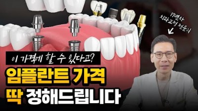 임플란트 가격 비용이 차이나는 이유 및 저렴하게 할수있는 방법 추천